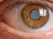 PT HEALTH WATCH: Delayed treatment of childhood cataracts can lead to irreversible vision loss – plateaureports
